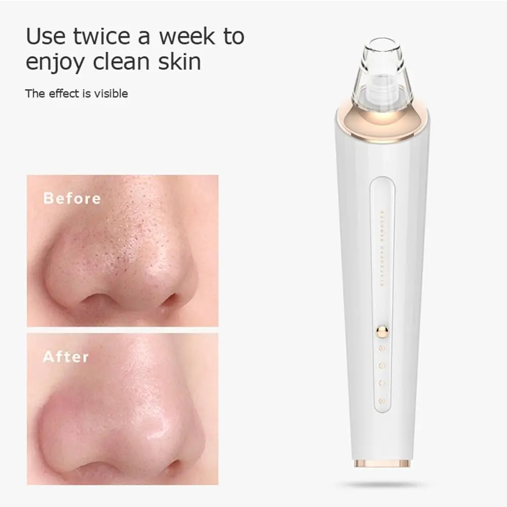 Appareil soin visage nettoyage profond