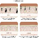 extracteur-de-points-noirs-électrique-natitingou.webp